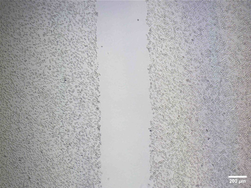 Cell migration assay